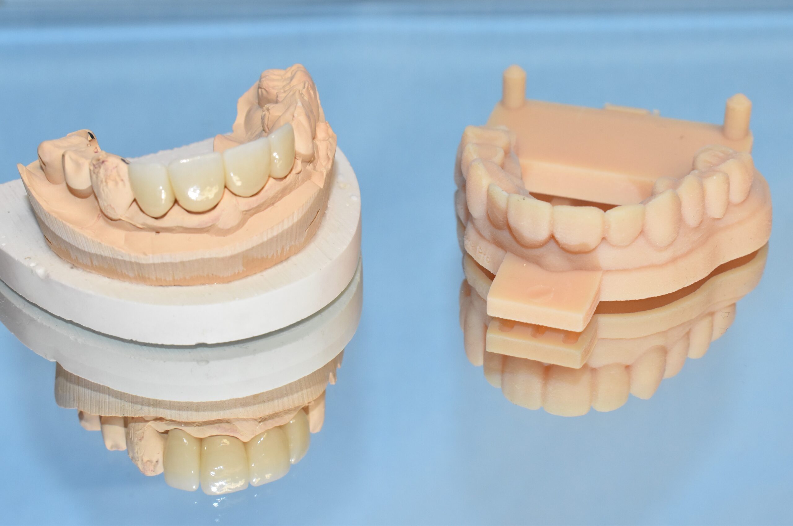 Dental Crowns