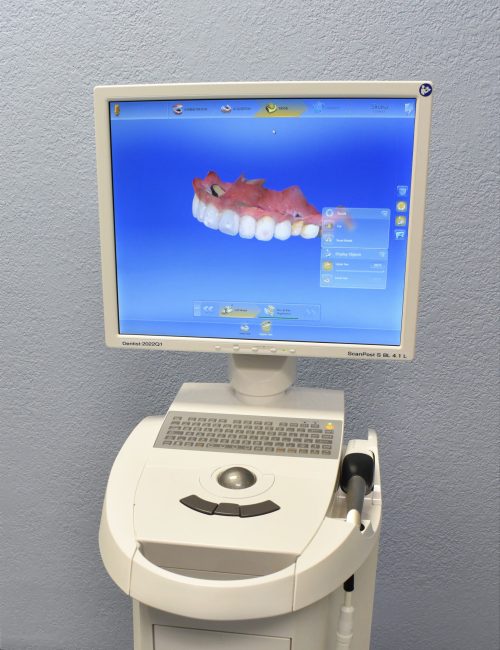 Dental Crown Scanner Machine